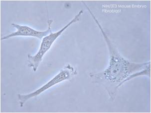 Familial hypercholesterolemia (FH)