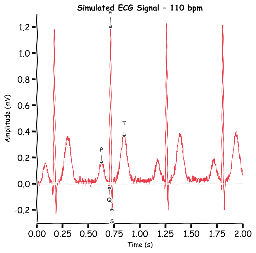 Simulated ECG waveform